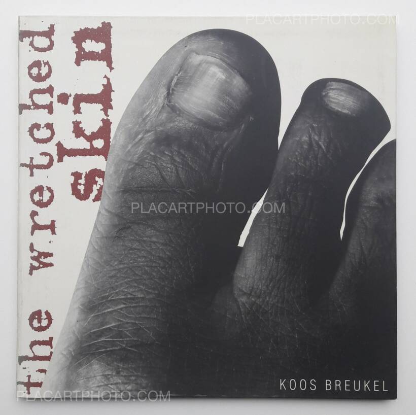 Koos Breukel: The Wretched skin (DEDICATED), De Verbeelding, 1994