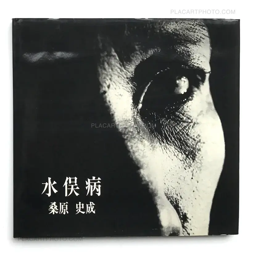 Fumiaki (Shisei) Kuwabara – Minamata Disease