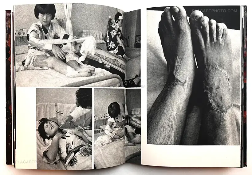 Ken Domon – Hiroshima (Signed)
