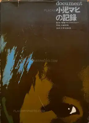 Tadao Mitome – Document : Shonimahi no kiroku / Document : Record of Infantile paralysis